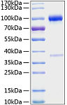 Recombinant Mouse TNFRSF11B/Osteoprotegerin Protein (RP01059)