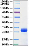 Recombinant Mouse VEGF-A/VEGF164 Protein (RP01060)