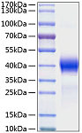 Recombinant Mouse Dkk-1 Protein (RP01062)