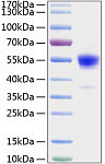 Recombinant Rat IFN-gamma Protein (RP01075)