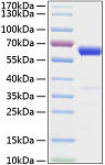 Active Recombinant Mouse IFN-beta Protein (RP01076)