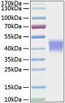 Recombinant Mouse IL-21R/CD360 Protein (RP01079)