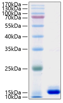 Recombinant Human PMP2 Protein