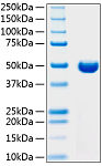 Recombinant Human DPEP1 Protein (RP01097)