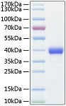 Recombinant Human TEM8/ANTXR1 Protein (RP01098)
