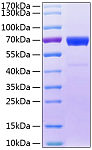 Recombinant Human IL-20RB Protein (RP01102)