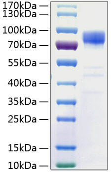 Recombinant Human SAP-90/PSD-95/DLG4 Protein