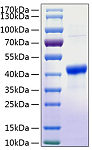 Recombinant Human Serpin B3/SCCA-1 Protein (RP01110)