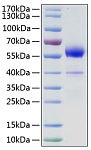 Recombinant Human VEGF-B Protein (RP01118)