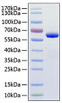 Recombinant Human TNFSF13/APRIL/CD256 Protein (RP01120)