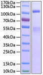 Recombinant Human IGF1R/CD221 Protein (RP01143)