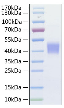 Recombinant Human Fc-gamma RI/CD64 Protein
