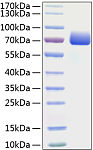 Recombinant Mouse B7-H1/PD-L1/CD274 Protein (RP01149)