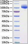 Recombinant Human FLT-2/FGFR-1/CD331 Protein (RP01151)