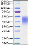Recombinant Mouse TIM-3/HAVCR2/CD366 Protein (RP01152)