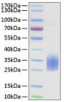Active Recombinant Human TREM-2 Protein (RP01159)