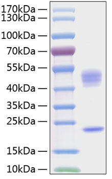 Recombinant Human IL-23/IL-12B&IL-23A Protein