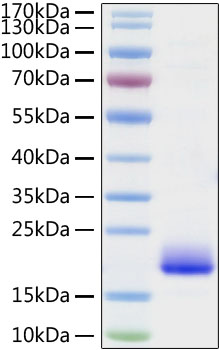 Recombinant Mouse IL-4 Protein