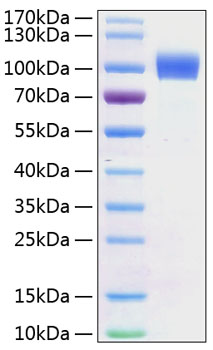 Recombinant Mouse ErbB-2/HER2/CD340 Protein