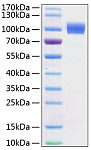 Recombinant Mouse ErbB-2/HER2/CD340 Protein (RP01165)