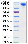 Recombinant Mouse ErbB-2/HER2/CD340 Protein (RP01166)