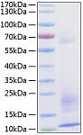 Recombinant Human TSLP Protein (RP01171)