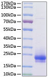 Recombinant Human Flt4 ligand/VEGF-C Protein (RP01173)