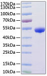 Recombinant Human Renin/REN Protein (RP01175)