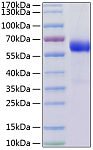 Recombinant Human TNFRSF3/TNFR-III/LTBR Protein (RP01179)