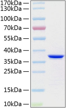 Recombinant Human Annexin A5/ANXA5 Protein