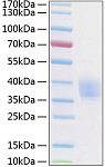 Recombinant Human Endothelial protein C receptor/CD201 Protein (RP01181)