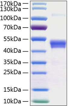 Recombinant Human TSG-14/PTX3 Protein