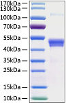 Recombinant Human TSG-14/PTX3 Protein (RP01182)