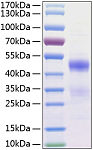 Recombinant Human NovH/CCN3(N97K) Protein (RP01186)