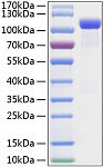 Recombinant Mouse EphB2 Protein (RP01191)