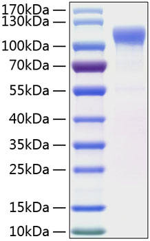 Recombinant Human LRRC4 Protein