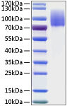 Recombinant Human MERTK Protein (RP01198)