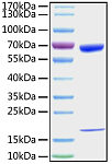 Recombinant Mouse PCSK9 Protein (RP01200)
