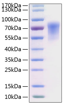 Recombinant Human CADM1/IGSF4A Protein