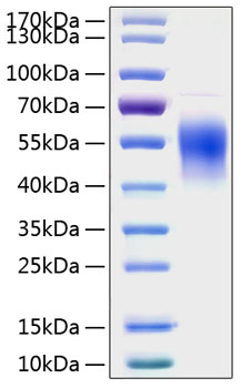 Recombinant Human IL-2RG/CD132 Protein