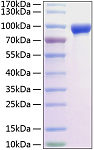 Recombinant Rat MMP-9 Protein (RP01212)