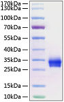 Recombinant Human TNFRSF5/CD40 Protein (RP01214)