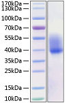 Active Recombinant Mouse CSF-1/M-CSF Protein (RP01216)