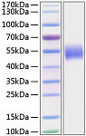Recombinant Human Nectin-1/PVRL1/CD111 Protein (RP01219)