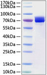 Recombinant Human Mesothelin/MSLN Protein (RP01220)