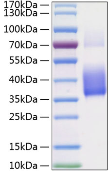 Recombinant Human CSF-1/M-CSF Protein