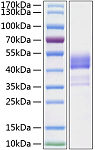 Recombinant Human TNFRSF13C/BAFF-R/CD268 Protein (RP01223)