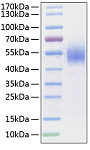Recombinant Human Fc-gamma RI/CD64 Protein (RP01226)