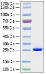 Recombinant Human FGF-19 Protein (RP01231)
