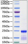 Recombinant Human GTPase KRas/KRAS(G12V) Protein (RP01239)